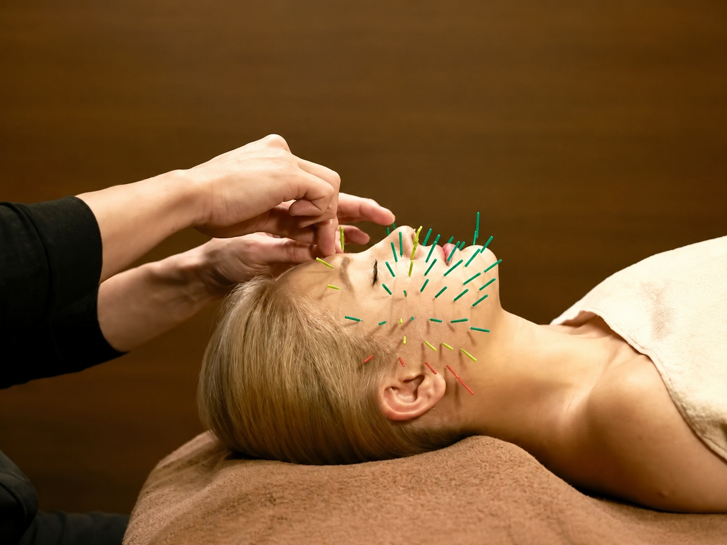 Cosmetic acupuncture treatment at Balanced Vitality